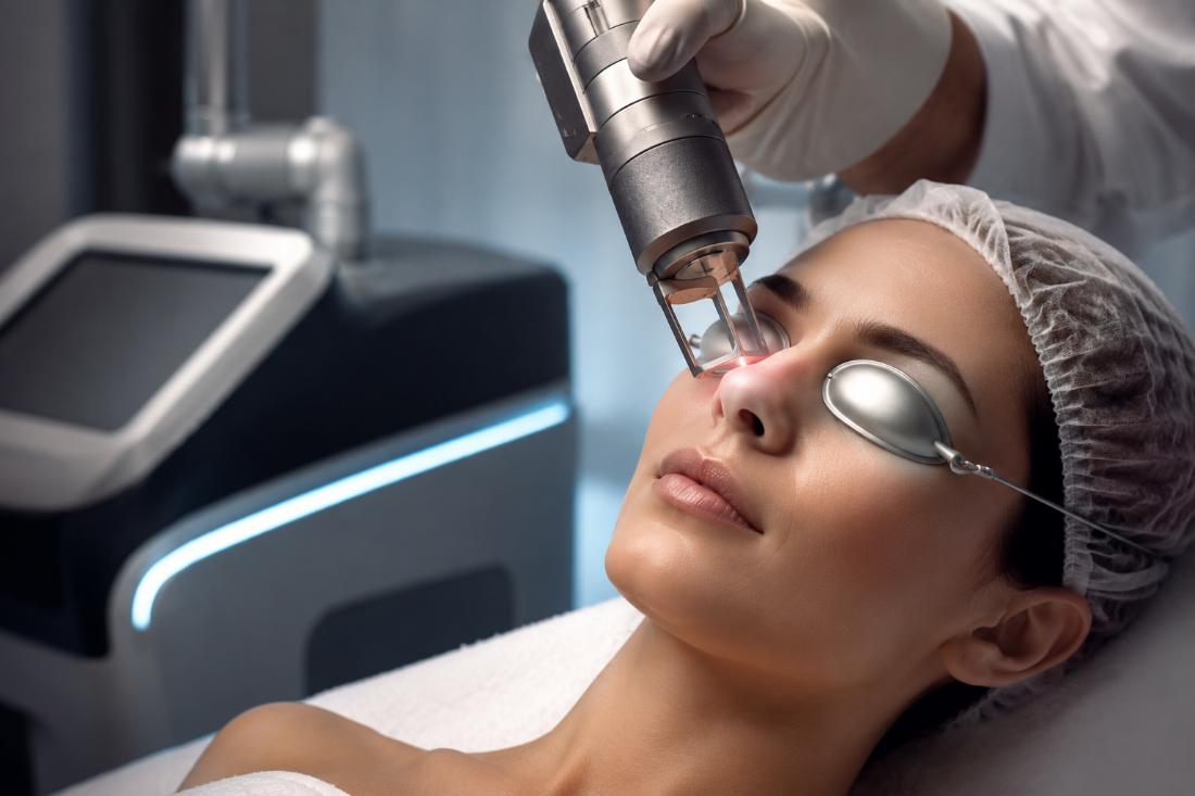 Laser de picossegundos: como funciona, para que serve e quais são as diferenças entre os lasers