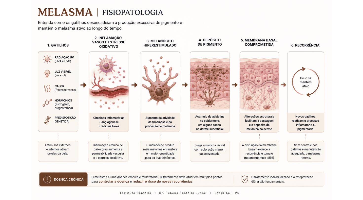 quadro melasma