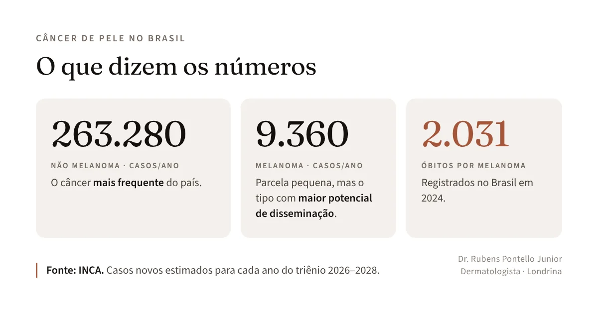 Números do câncer de pele no Brasil segundo o INCA: 263.280 casos de não melanoma e 9.360 de melanoma por ano