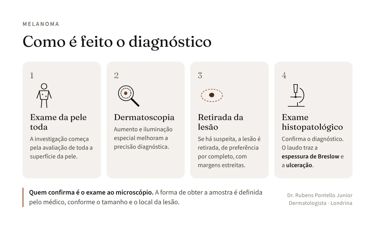 Etapas do diagnóstico do melanoma: exame da pele, dermatoscopia, retirada da lesão e exame histopatológico