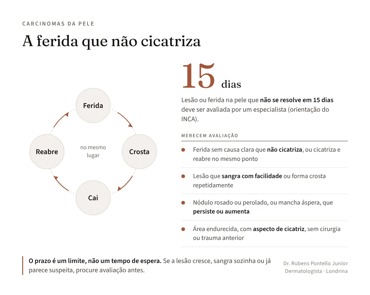 Ciclo da ferida que não cicatriza e orientação de avaliar lesões que não se resolvem em 15 dias