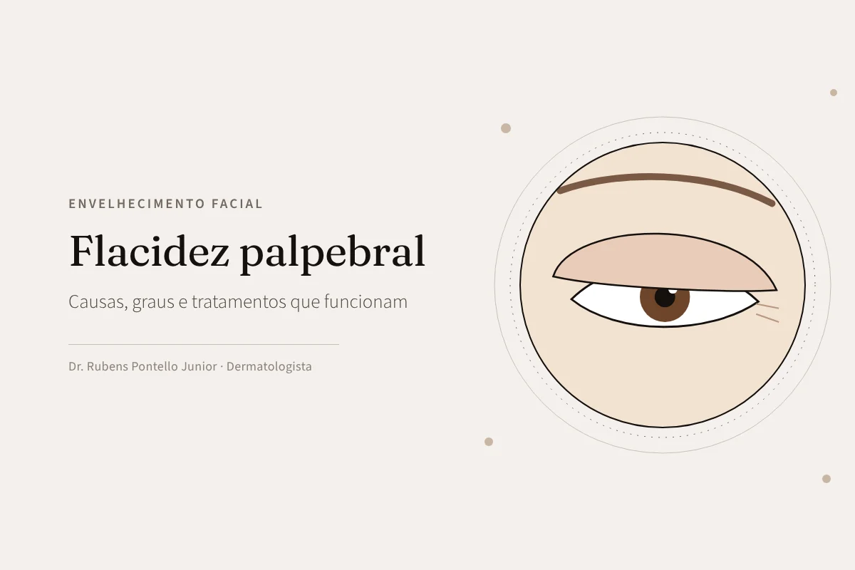 Flacidez palpebral: causas, graus e tratamentos que funcionam