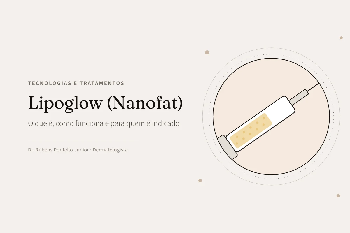 Lipoglow (Nanofat): o que é, como funciona e para quem é indicado