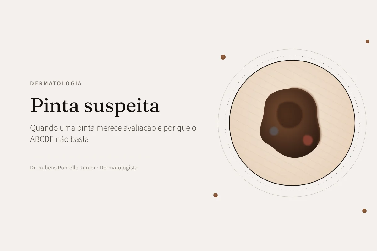 Pinta suspeita: quando uma pinta merece avaliação e por que o ABCDE não basta