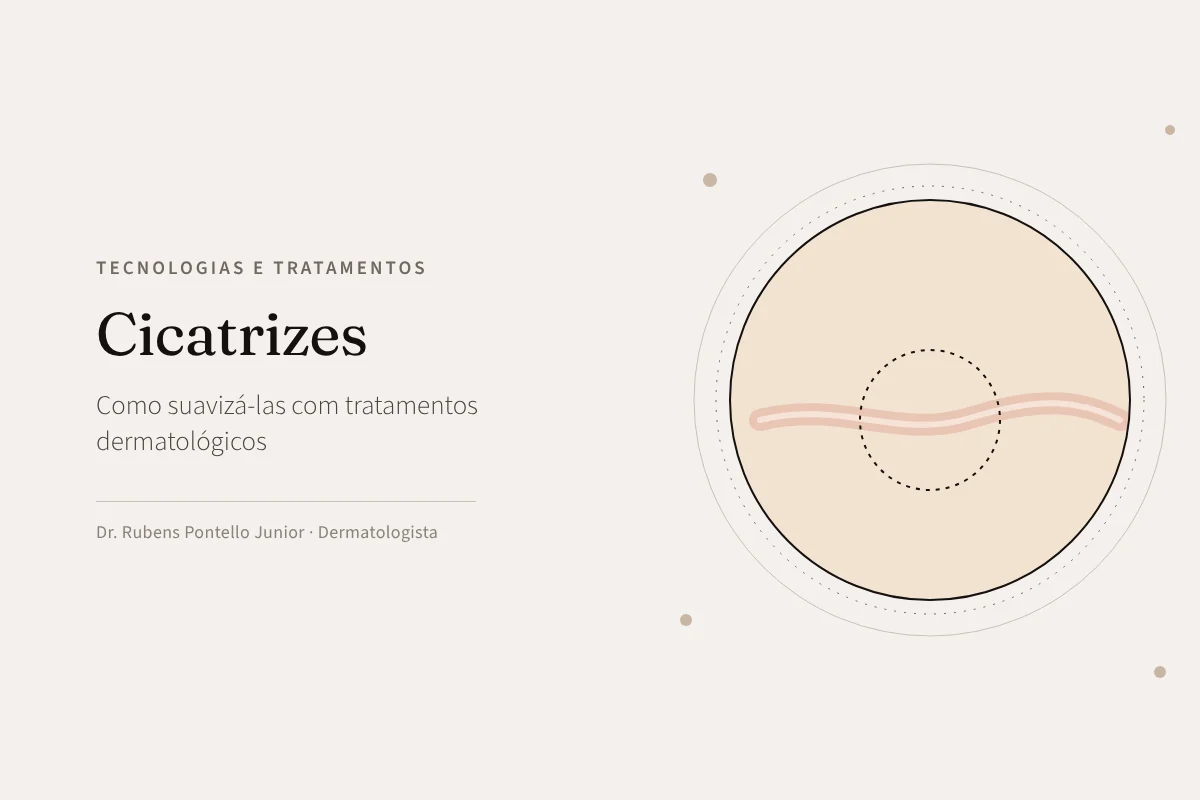 Cicatrizes: como suavizá-las com tratamentos dermatológicos avançados